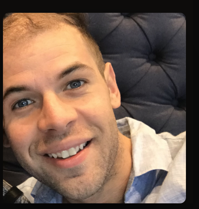 Dr. Charles Pereyra smiling, confident after his hair restoration journey