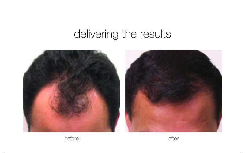 NGBA-3-1-e1730730260269-qwkdxhxlqgitp84dlo87436y9m1p92ti7bvsd8o87c