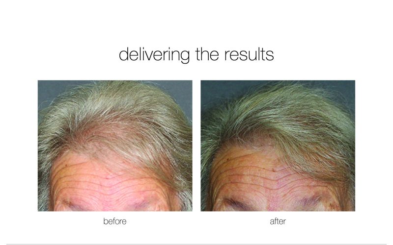 NGBA-5-e1730730189645-qwkdvn7297zgswtbfddop218396n2kgka5kbalf6h4