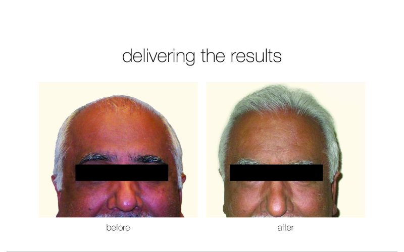 NGBA-6-e1730730157520-qwkdut486iuahe10b0dmh9mh2xaw8955i0orxqns08