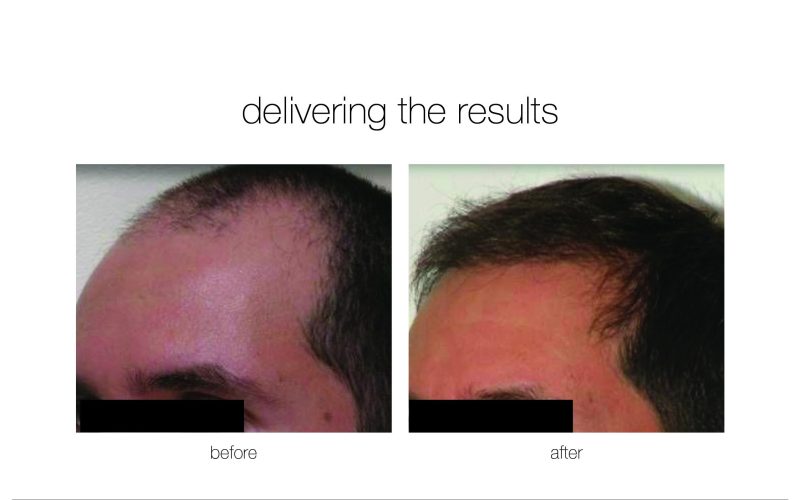 NGBA-7-e1730730118131-qwkdtsgirzg3wli992j6a0vhwwbkw23mcz8u7y64qw