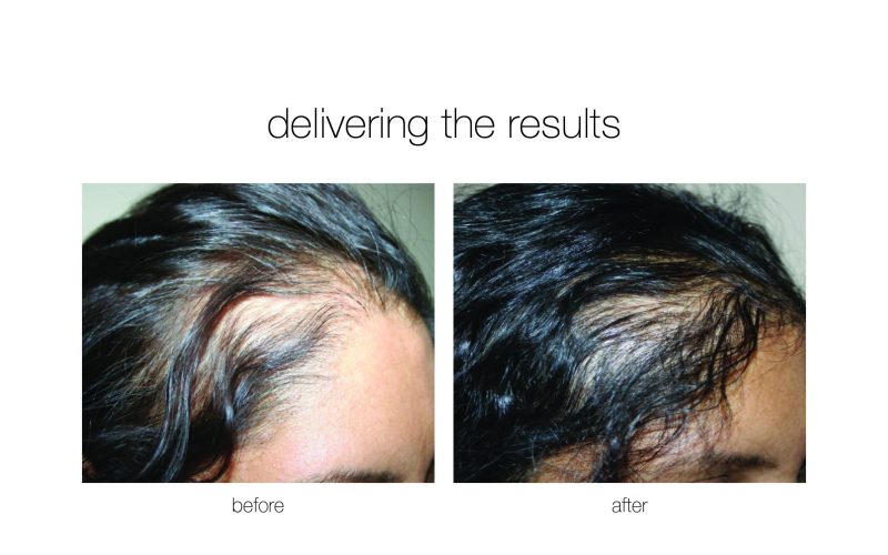 NGBA-8-e1730730090573-qwkdt251gmg2vikhir5mc7ila3xawj74xcz8s795l4