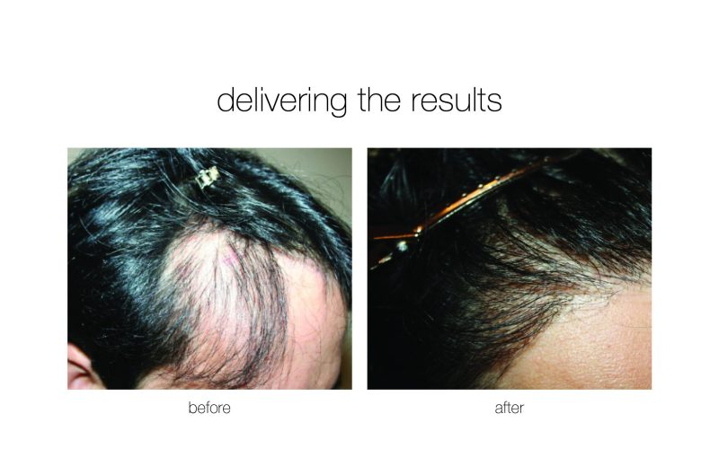 NGBA-9-e1730730059309-qwkds901krc6vlqt8wk6owvav5wx9wzghcr6wmgcy0