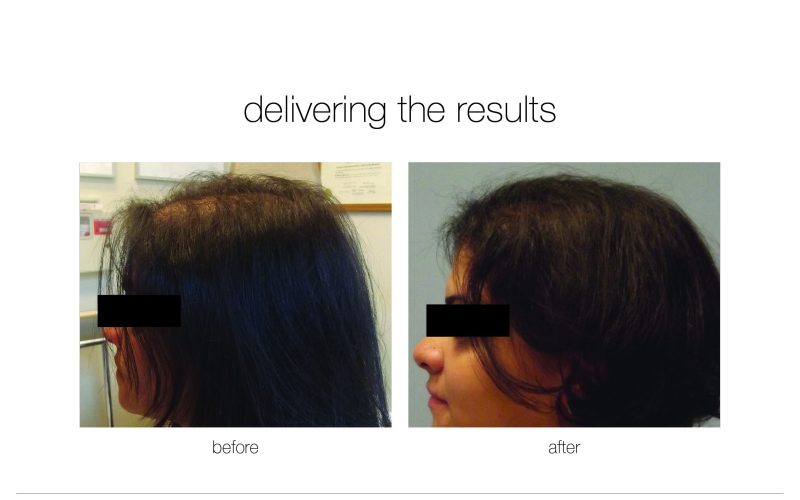 NGBA-e1730730021810-qwkdr9a6d1zamf6p1h4d25vsaisz5f1nofyqo3xbig