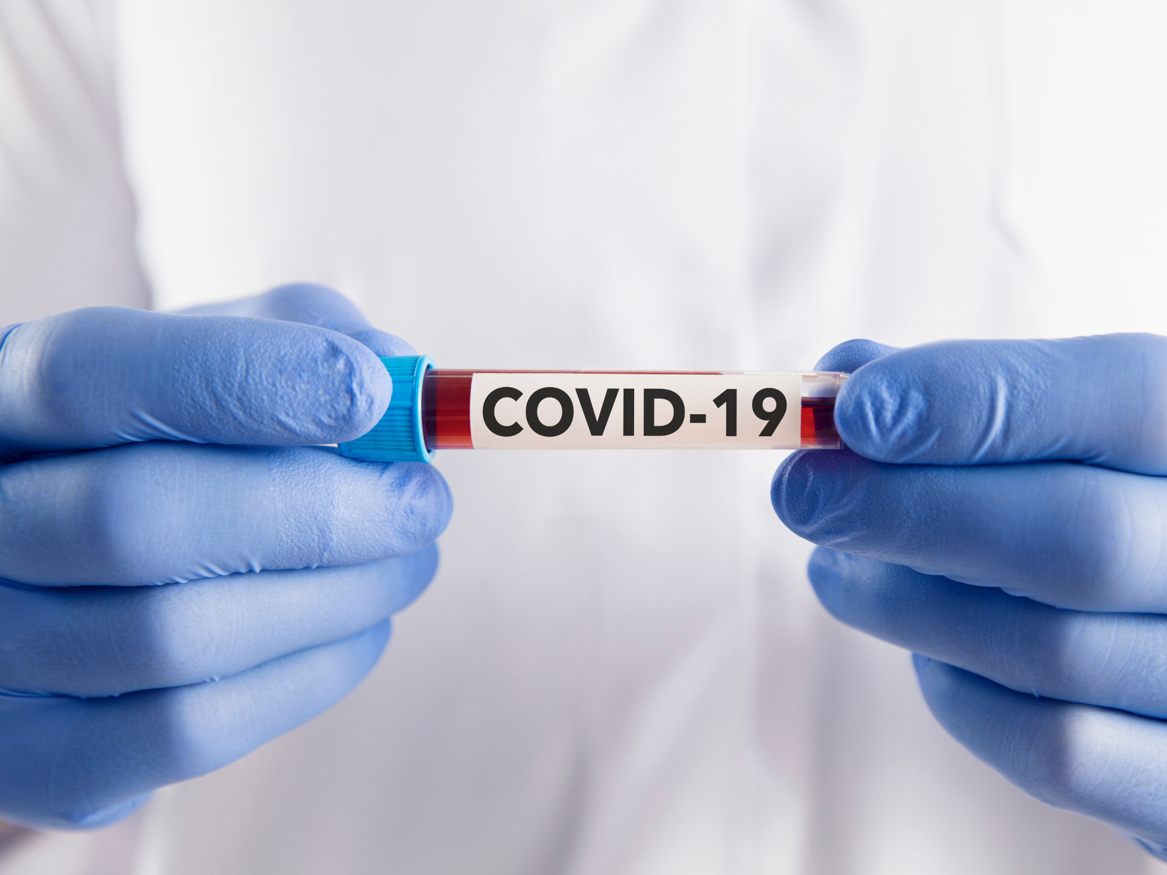 Covid-19 Treatment
